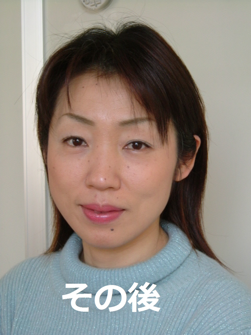 その後