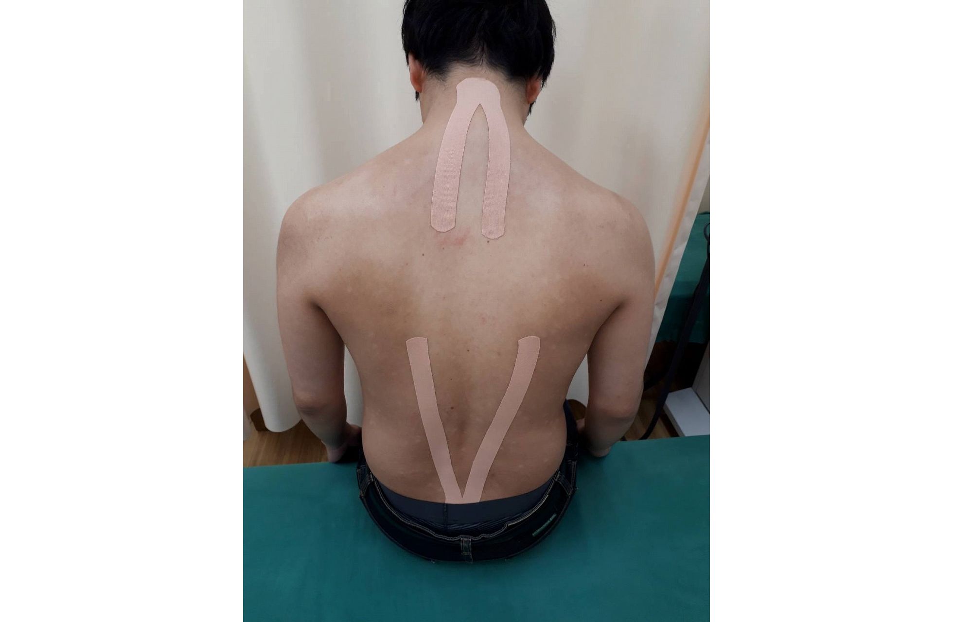 テープ治療(キネシオ・スパイラルなど）